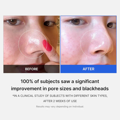 Medicube Zero Pore Pads 2.0 | 70 almofadas - imagem 3