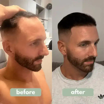Be BodyWise - Hair Growth Serum
