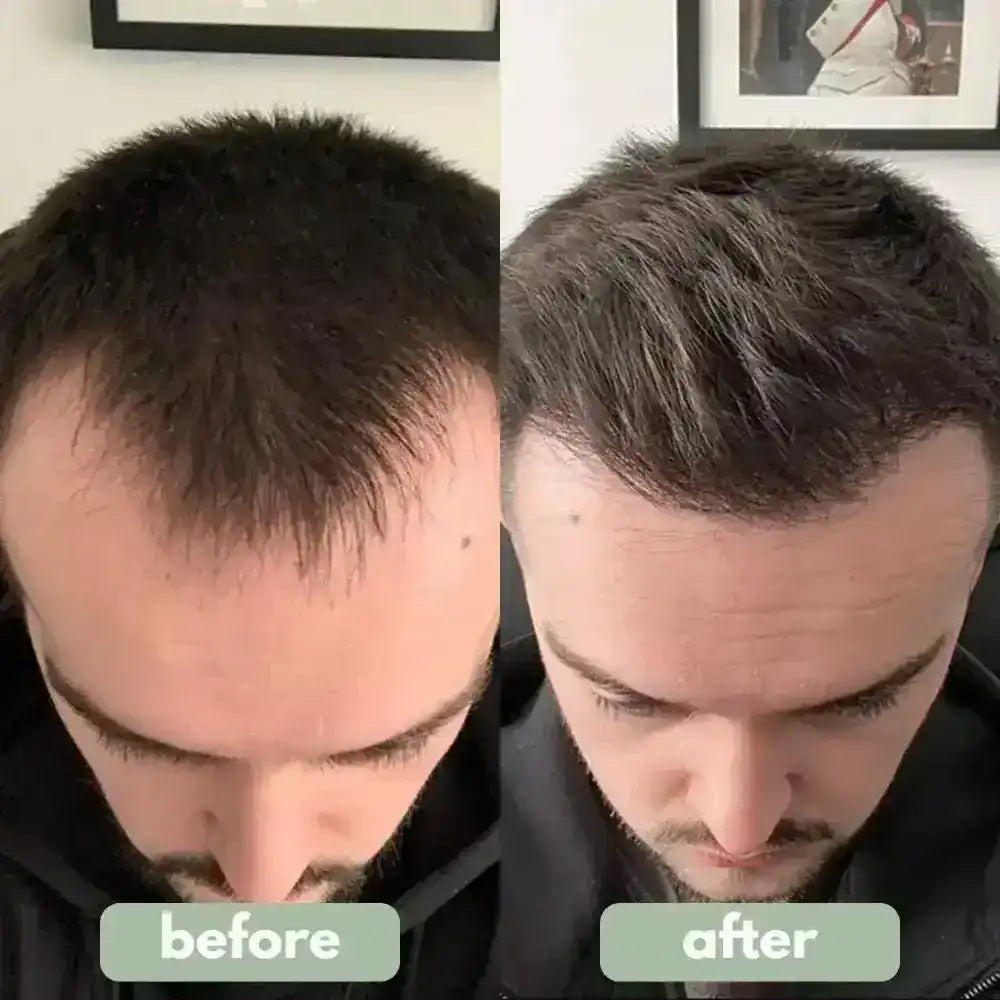 Be BodyWise - Hair Growth Serum
