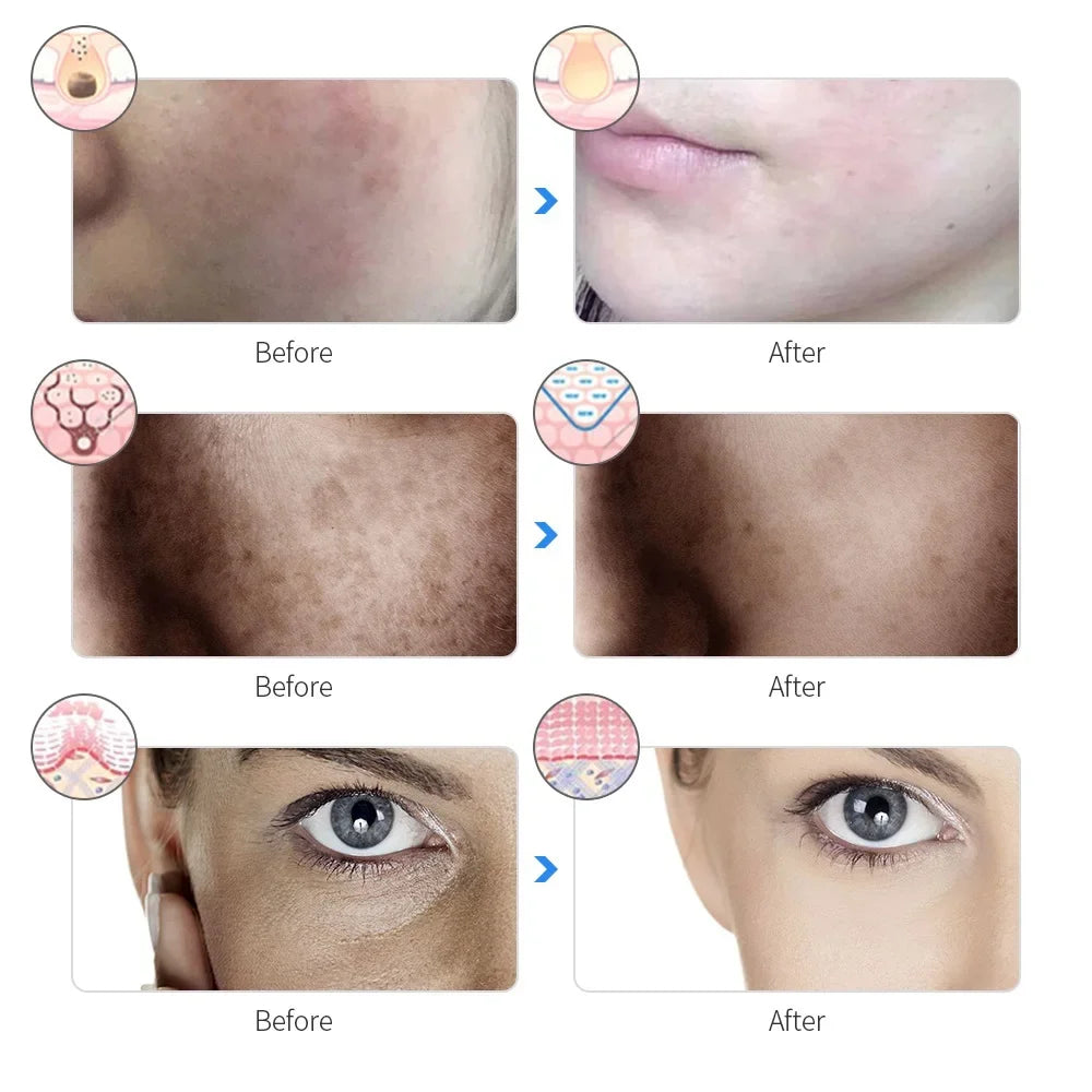 AuraLuz — Máscara Facial LED 7 Cores