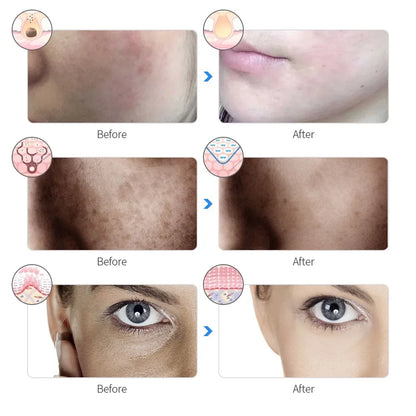 AuraLuz — Máscara Facial LED 7 Cores
