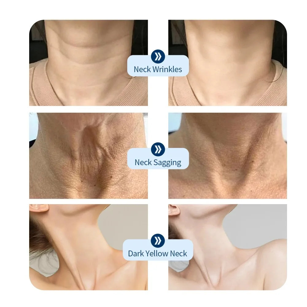 AuraLuz — Máscara Facial LED 7 Cores