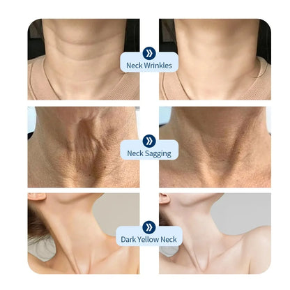 AuraLuz — Máscara Facial LED 7 Cores