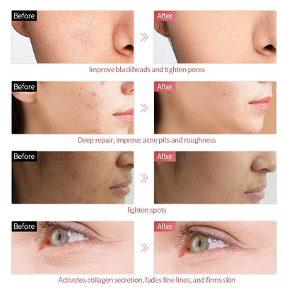 AuraLuz — Máscara Facial LED 7 Cores