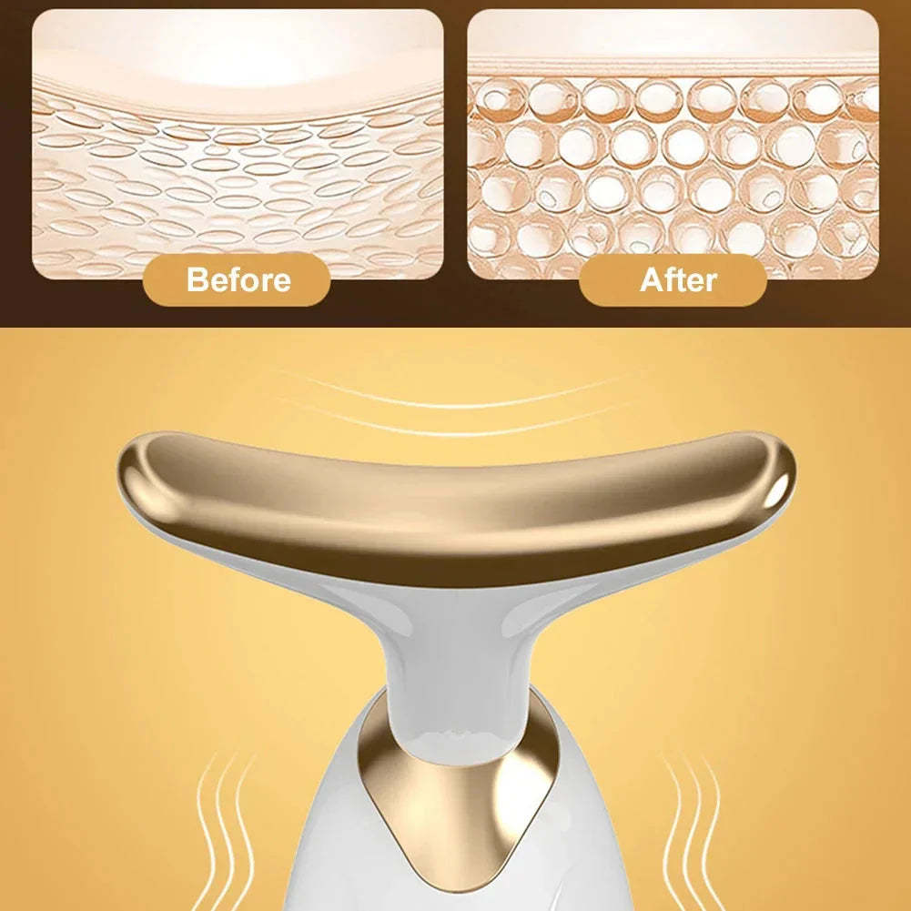 Dolphin Facial Lifter - product view 4