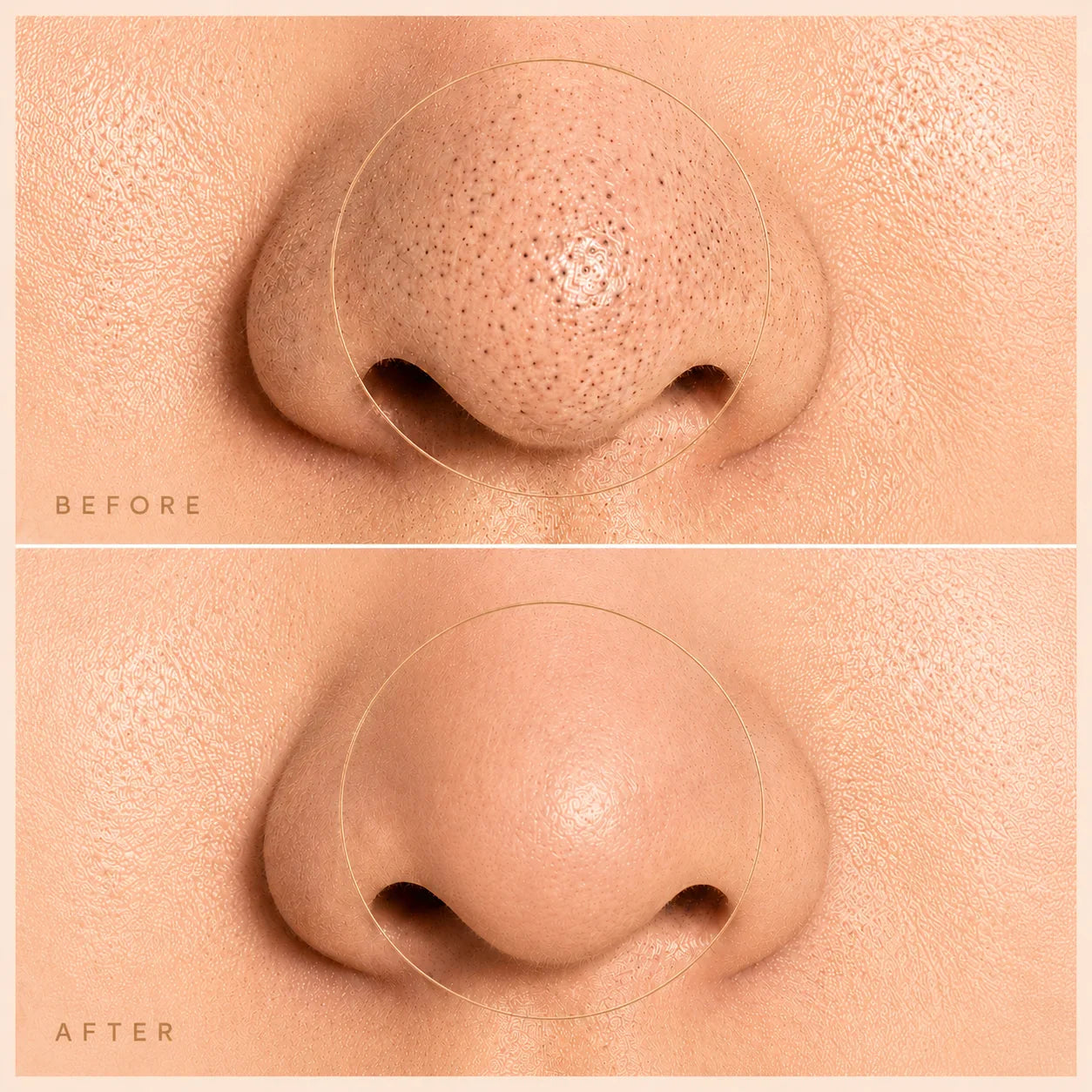 PoreClear™ Facial Extractor Pro - product view 2